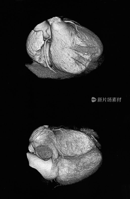 人类心脏MRI 3D图像
